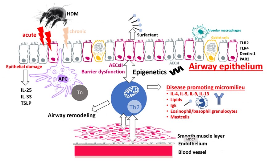 Übersichtsgrafik zu allergischem Asthma Übersichtsgrafik zu allergischem Asthma