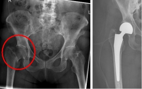 Oberschenkel 3 Oberschenkel 3
