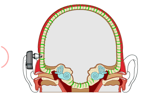 erd_015_DirectBoneConduction