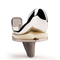 Persona Knieprothese Persona Knieprothese